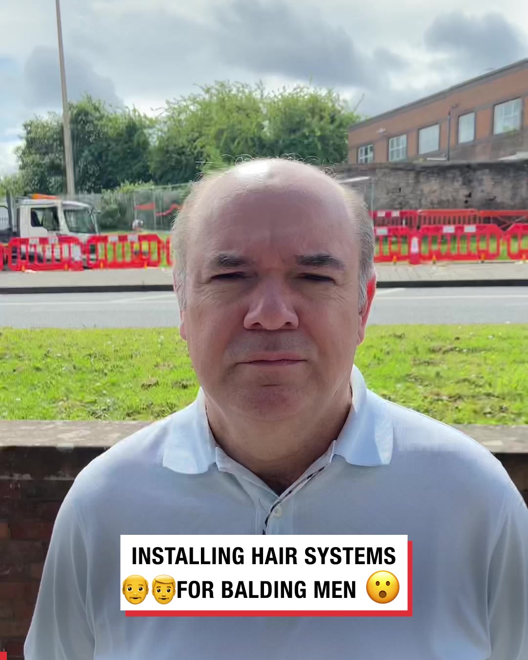ladbible-video-hub-installing-hair-systems-for-balding-men