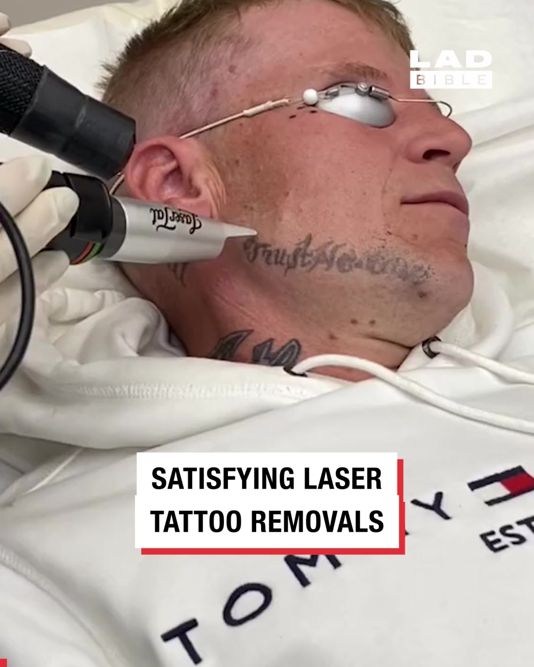 LADbible Video hub Satisfying Tattoo Removals